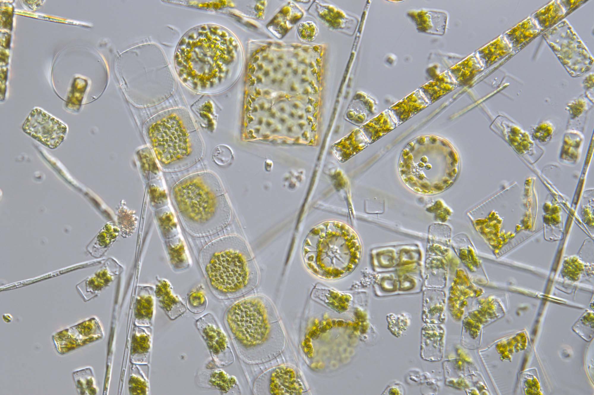 Diatoms under the microscope: Copyright Plymouth Marine Laboratory