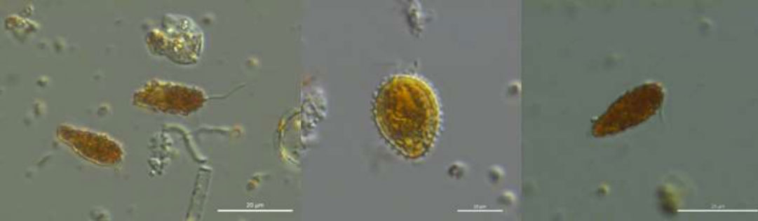 Microscopic image of Pseudochattonella plankton