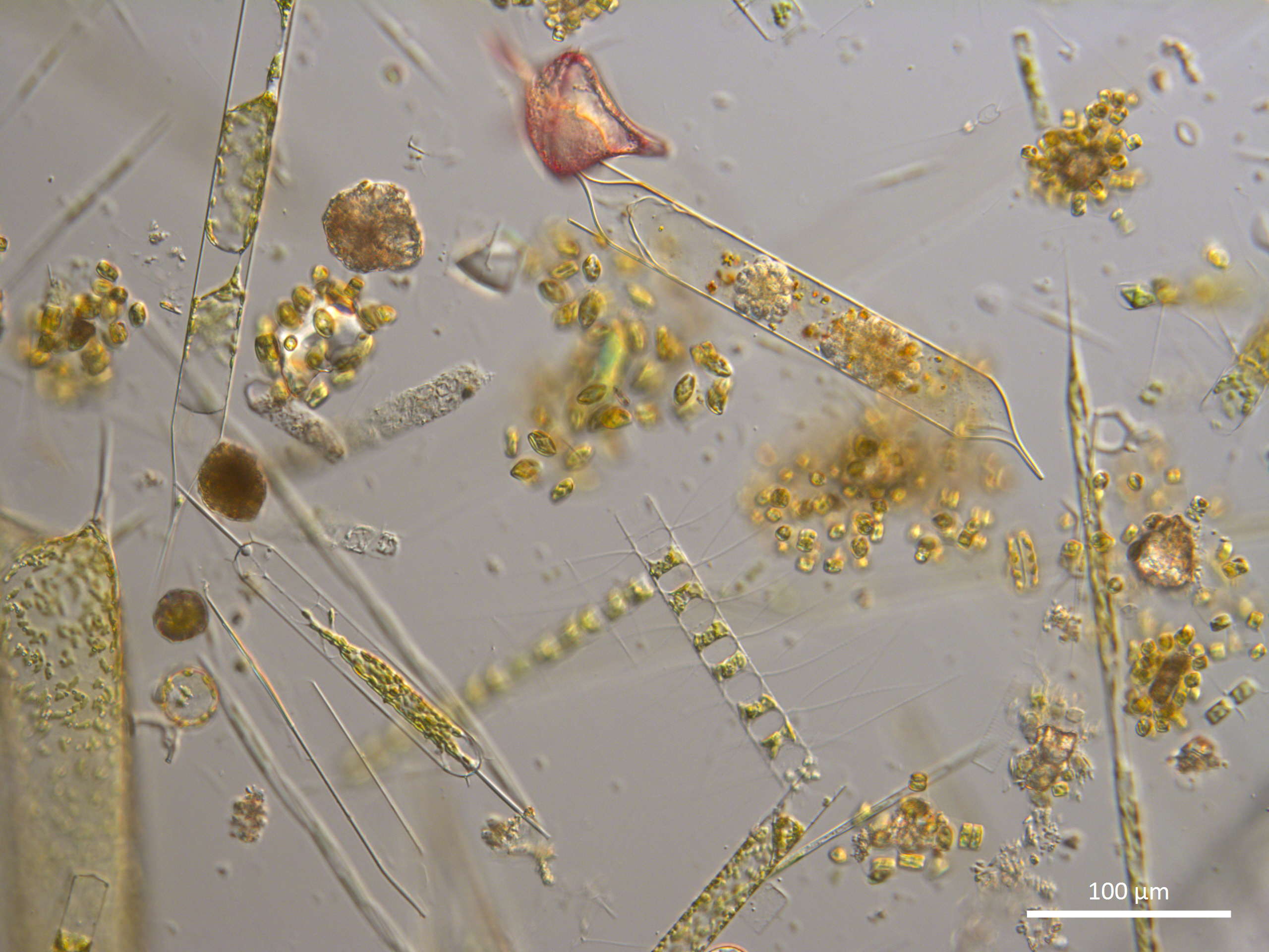 phytoplankton-(taken-in-September-2022-from-an-L4-sample).jpg