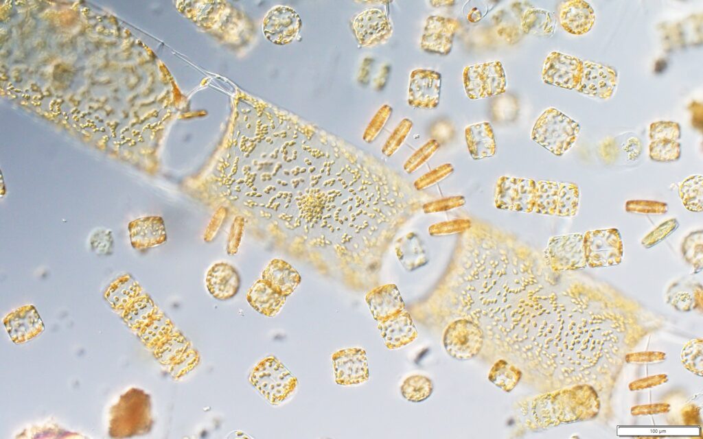microalgal plankton community