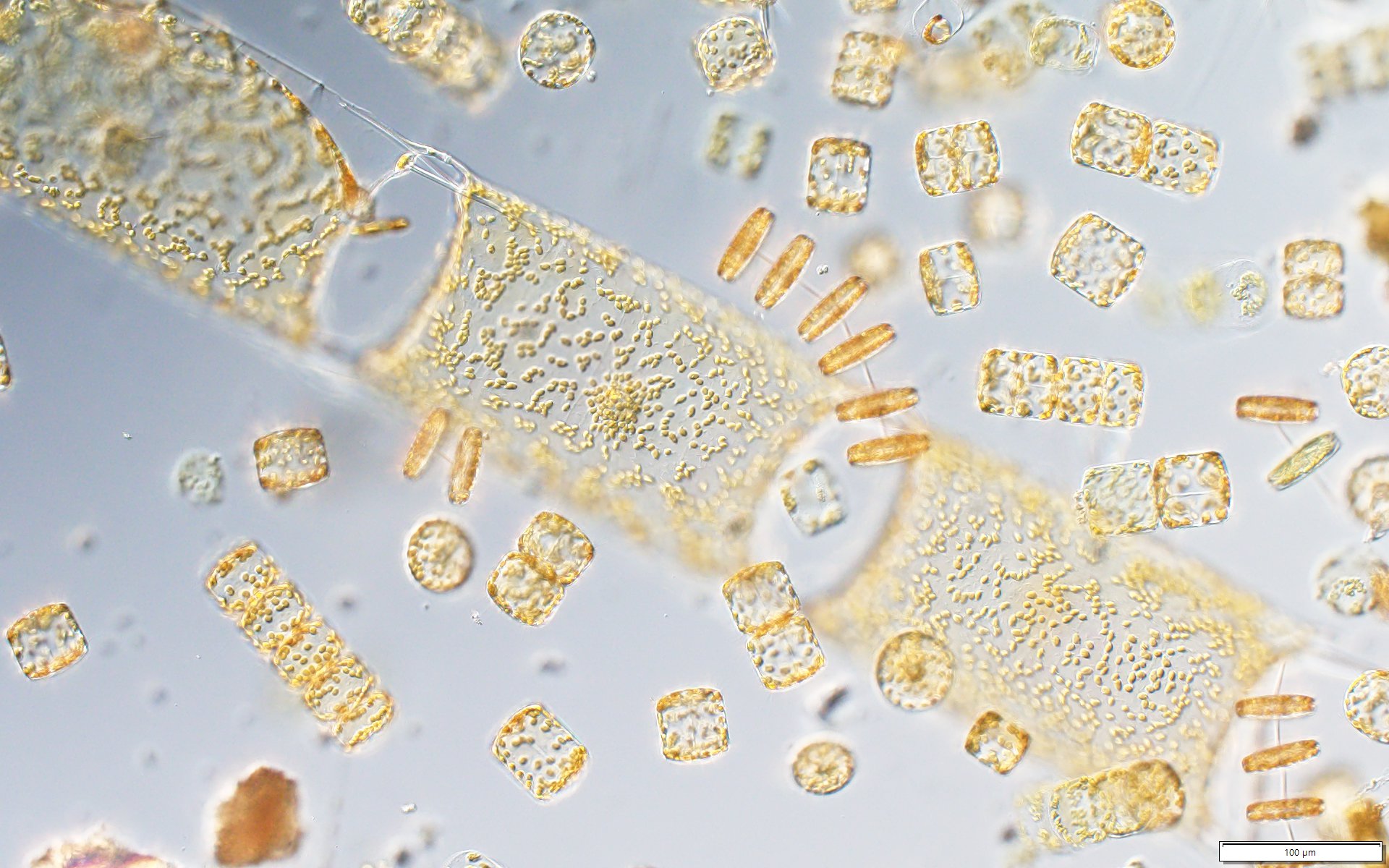 microalgal plankton community