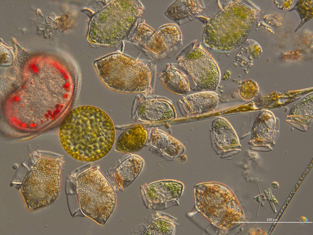 Plankton sample including Dinophysis. Claire Widdicombe, PML