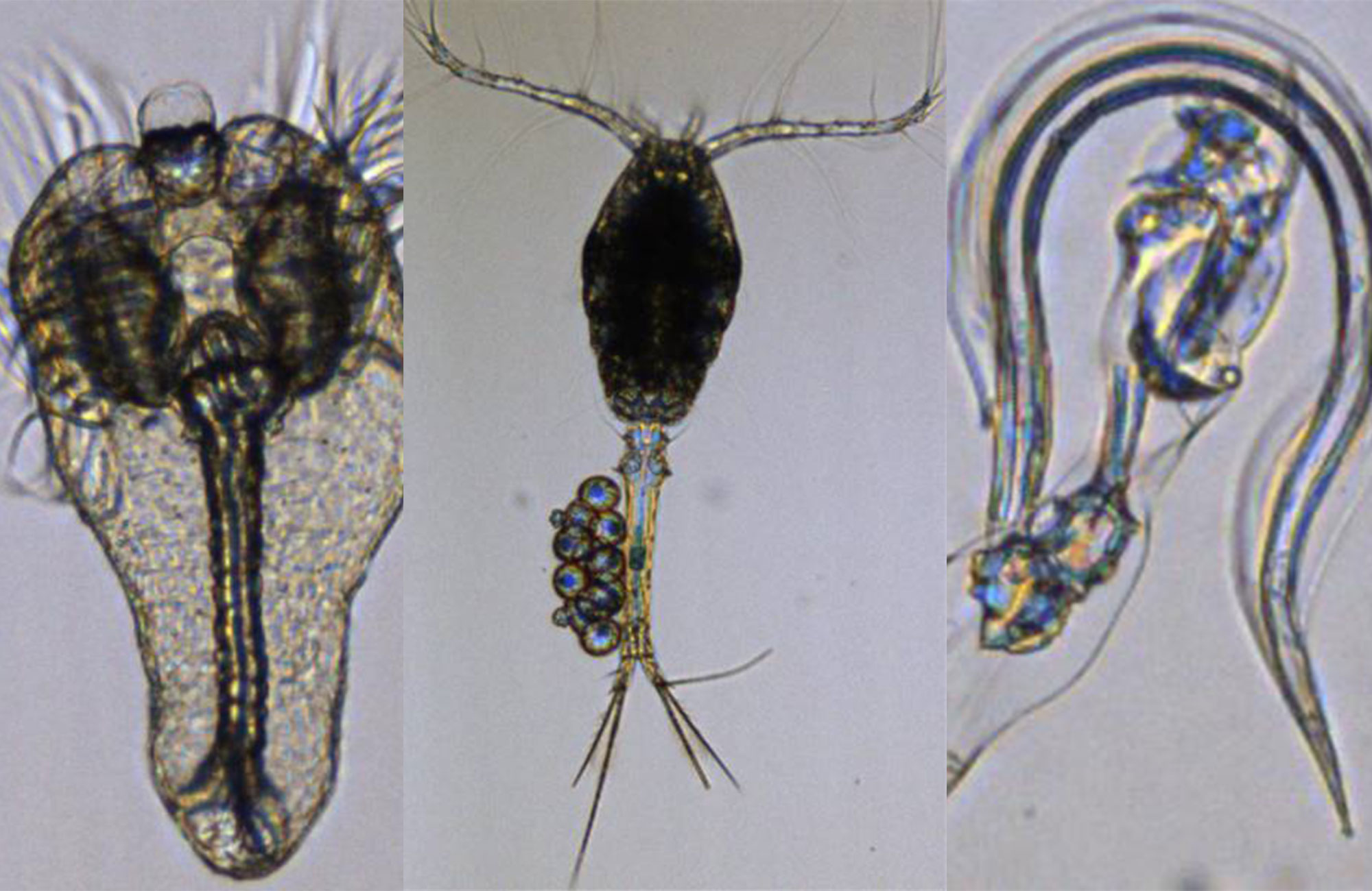 Three microscope images of Plankton